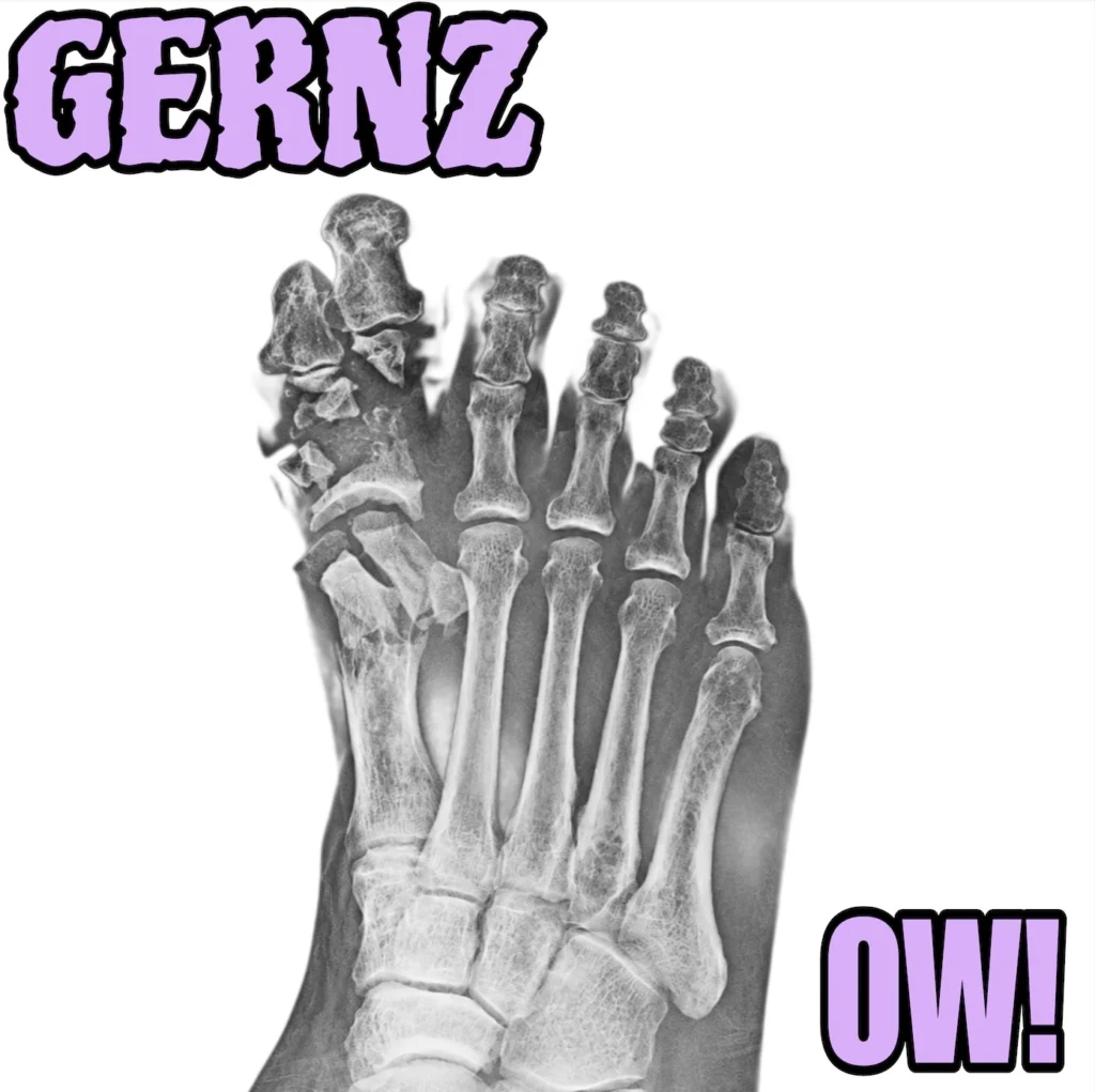 Regional South Australia’s Gernz Explode With a Volcanic Slice of Pure Aussie Grunge